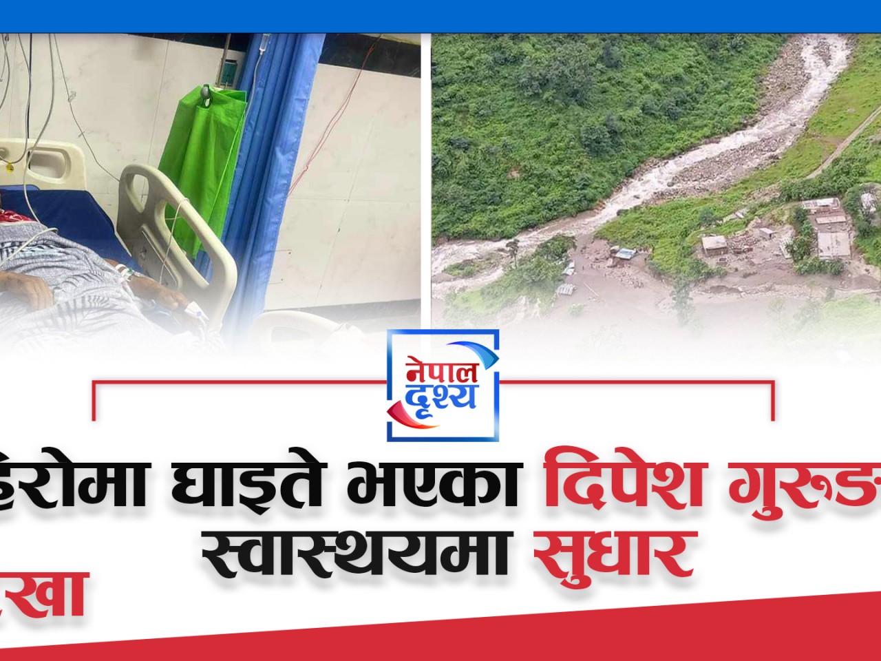 पहिरोमा घाइते भएका दिपेश गुरुङको स्वास्थयमा सुधार
